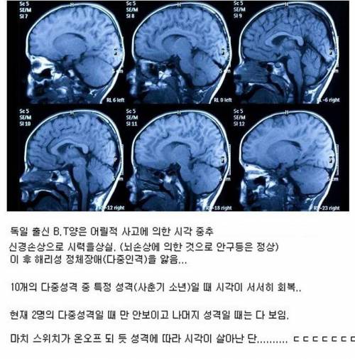 인간 뇌의 미스테리.jpg
