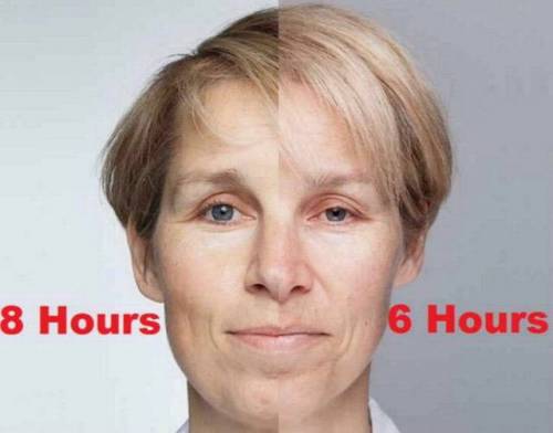 수면시간에 따른 얼굴변화.jpg