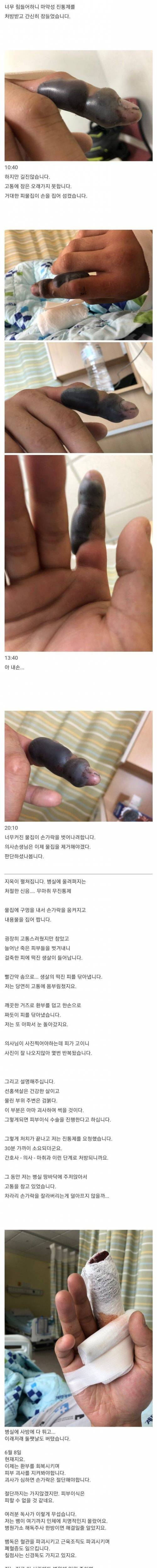 [스압] [극혐] 쇠살모사 한테 손가락 물린 후기.jpg