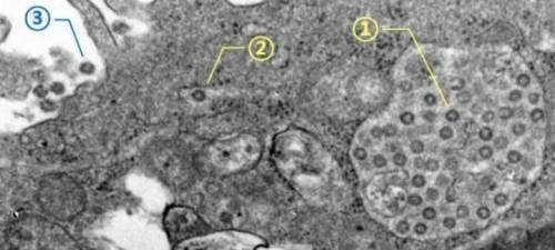전자현미경으로 포착한 코로나 바이러스 모습