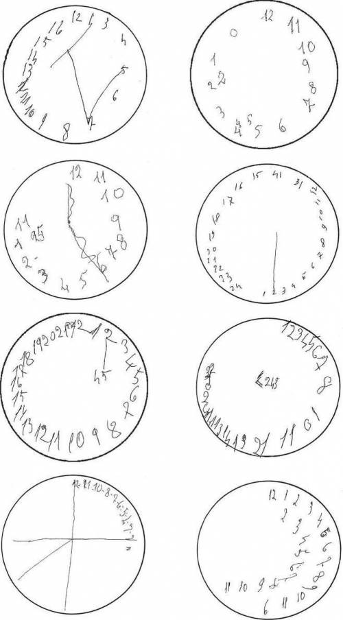 치매 환자들이 그린 시계.jpg