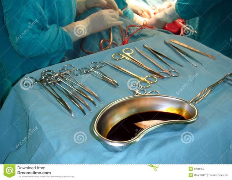 의사 수술 도구들
