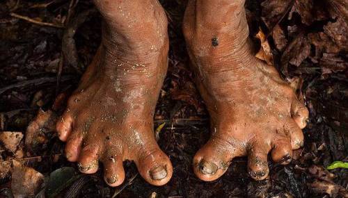 				천 년간 문명과 단절된 채 살아온 아마존 부족 발 모양