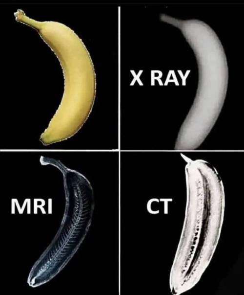 바나나로 보는 엑스레이,CT,MRI 차이점