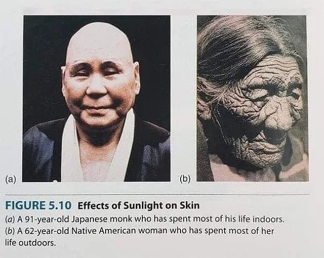 실내 생활한 91살 승려와 62살 미국 원주민의 피부차이.jpg