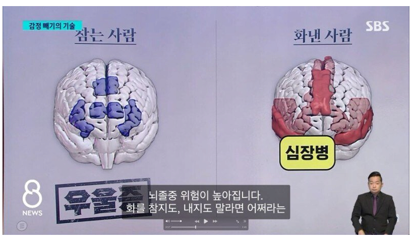 화 참는 사람 뇌 VS 화낸 사람 뇌 비교