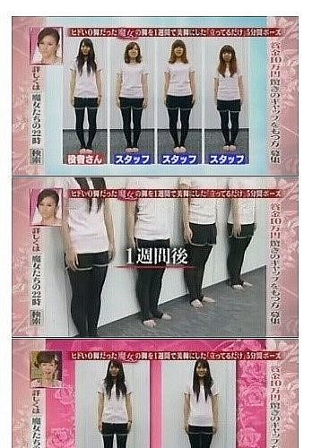 휜다리 교정법.jpg