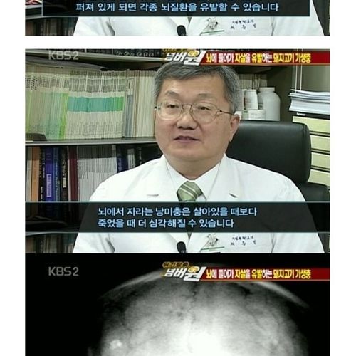 고기는 반드시 익혀먹자.jpg