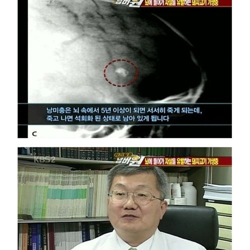 고기는 반드시 익혀먹자.jpg