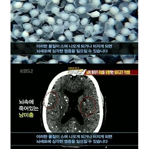 고기는 반드시 익혀먹자.jpg