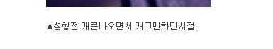 성형으로 인생역전.jpg