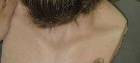 [스압]스타2의영웅 짐 레이너01