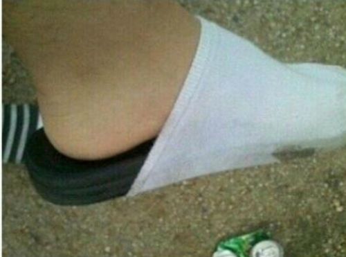 슬리퍼 끈 떨어졌을때 대처법.jpg