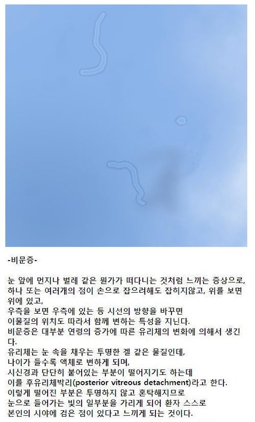 눈알 공감류.jpg