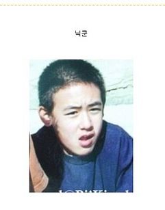 연예인 탈모.jpg