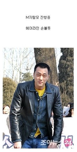 연예인 탈모.jpg