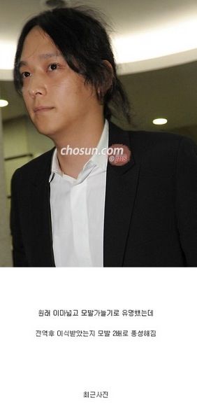 연예인 탈모.jpg