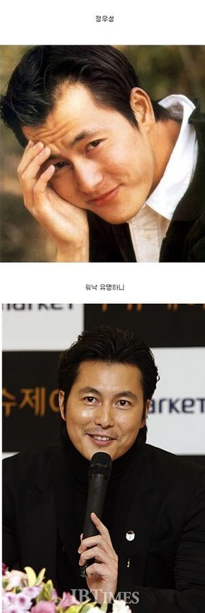 연예인 탈모.jpg