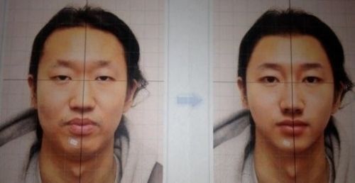 김경진, 3000만원짜리 가상 성형 사진
