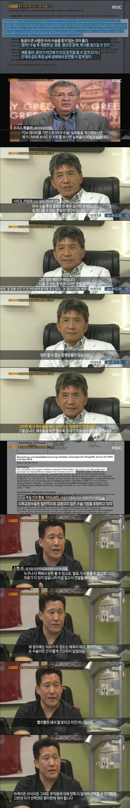 [스압]라식 라섹 부작용
