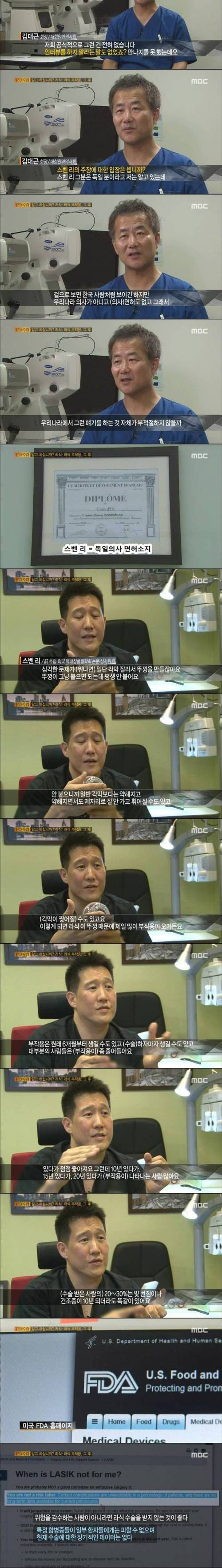 [스압]라식 라섹 부작용