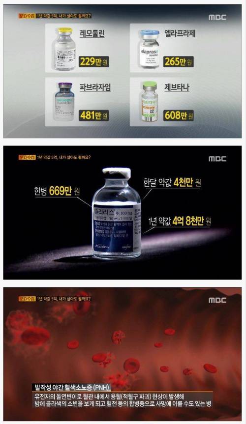 1년 약값 5억, 내가 살아도 될까요?