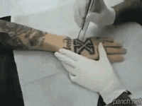 신개념 문신 제거.gif