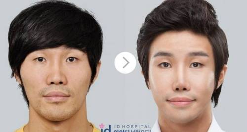성형한거 사람들이 거의 모르는 개그맨