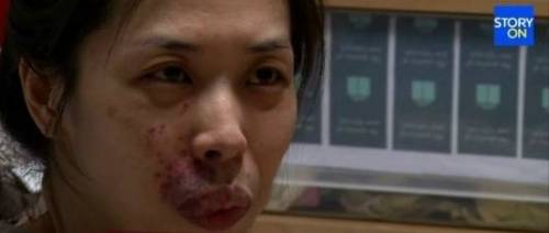 얼굴 못생겨서 취업도 실패했던 여성.jpg