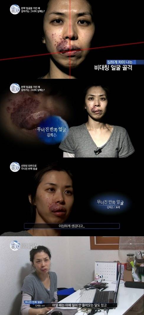 얼굴 못생겨서 취업도 실패했던 여성.jpg