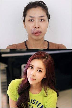 얼굴 못생겨서 취업도 실패했던 여성.jpg