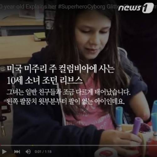 어느 소녀의 특별한 팔 .jpg