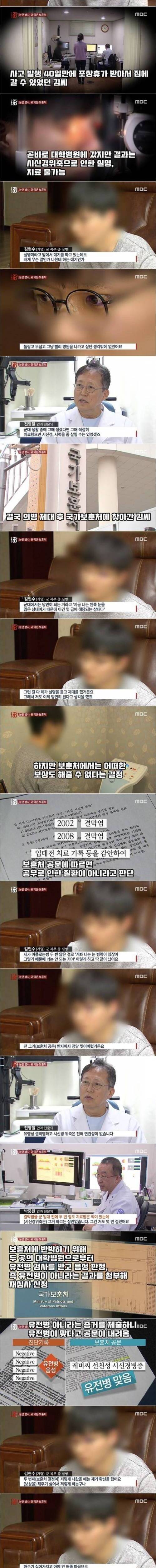 국 복무중에 실명당한 후기.jpg