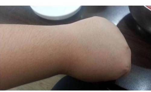 디씨 꿀주먹 근황.jpg