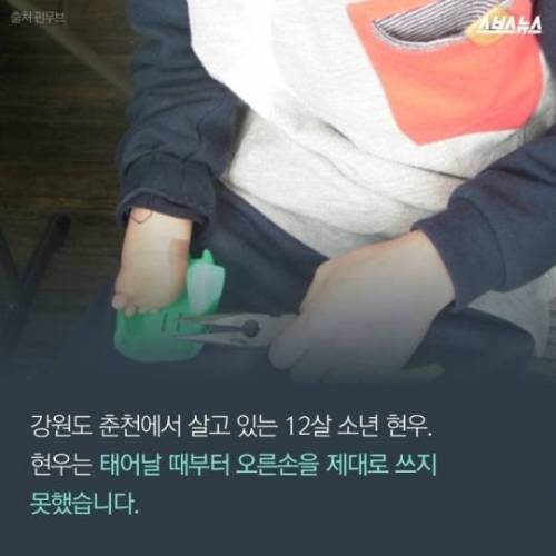 아버지와 함께 만든 '특별한 오른팔'