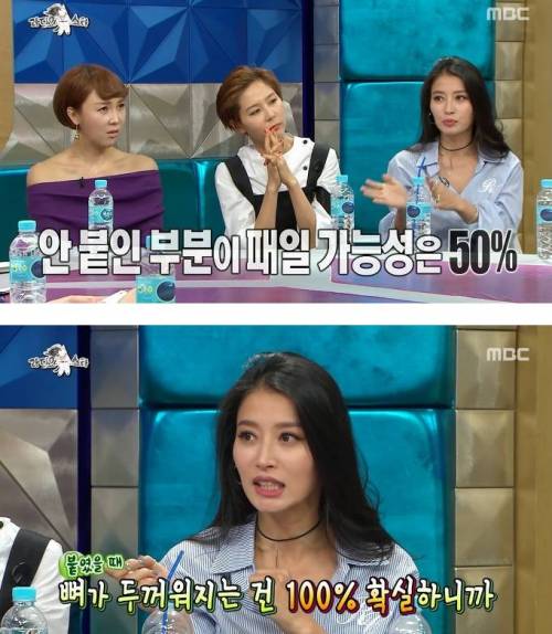 부러진 코뼈를 방치하는 이유.jpg