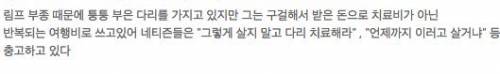 아픈다리로 구걸해 아시아 호화여행 하는 거지