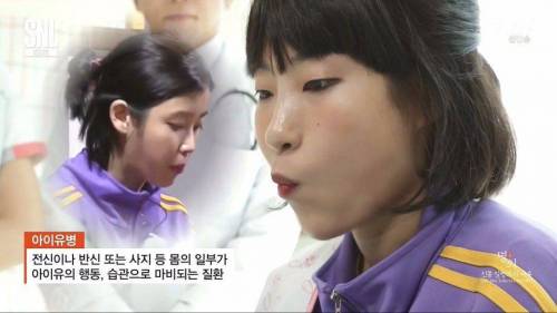 아이유병.jpg