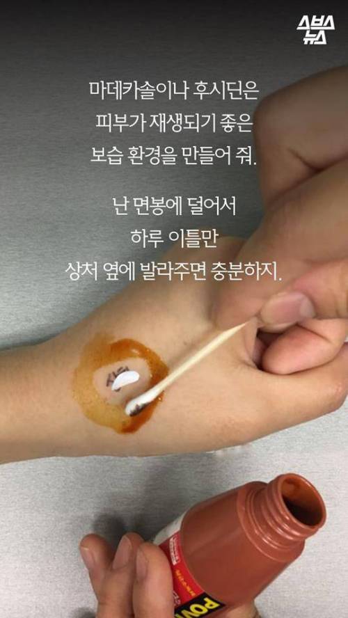 빨간약 올바로 바르는 방법.jpg