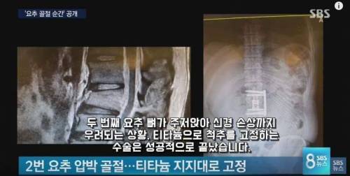 달인 김병만 사고당시 사진공개.jpg