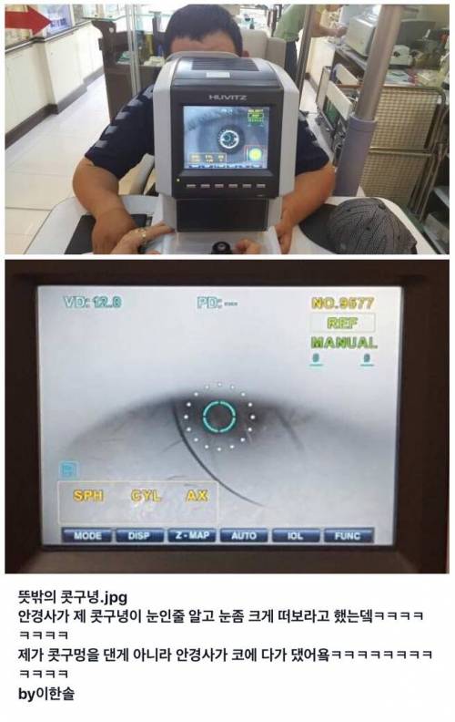 환자분, 눈 좀 크게 떠보세요.jpg