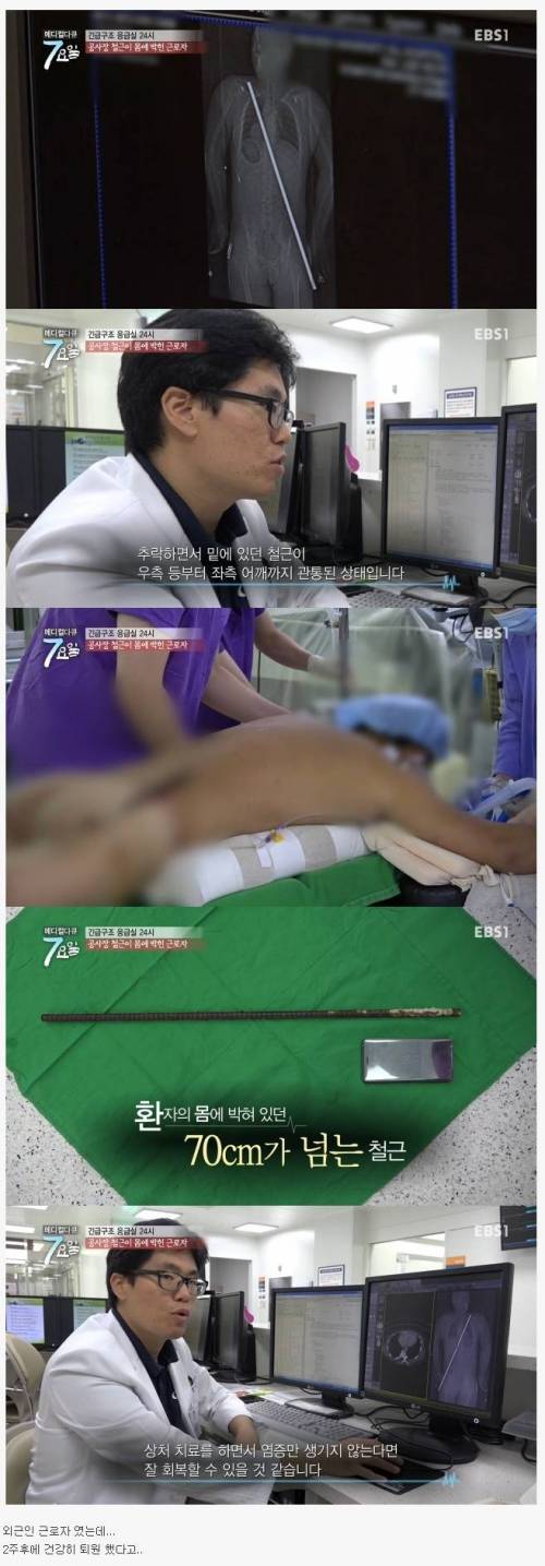 [약징]공사장 철근이 몸에 박힌 근로자.jpg