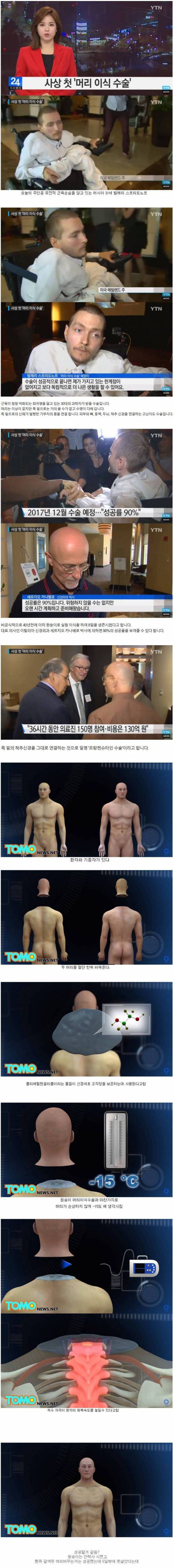 이번달에 행해질 예정이었던 역대급 수술.jpg