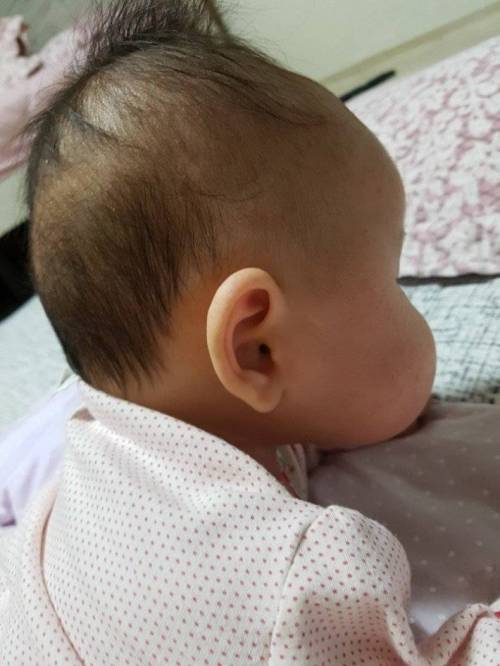 아기를 좋아하는 사람이라면 미치는 부위