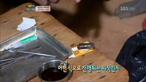 충격과 공포의 시술.jpg