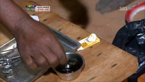 충격과 공포의 시술.jpg