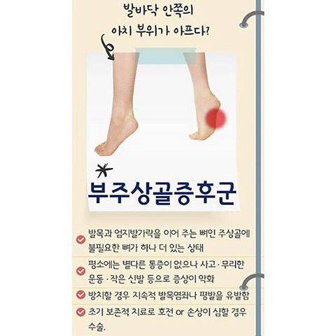 10명중 1명이 있다는 발의 뼈.jpg