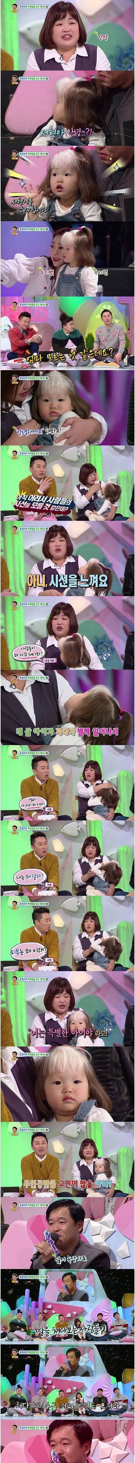 [스압] 백색증을 갖고 태어난 딸.jpg