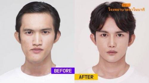 한국에서 성형한 태국남자 jpg