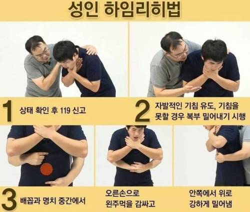 하임리히법...jpg